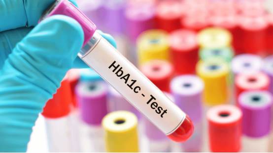 What is Glycated Hemoglobin (HbA1c) test?