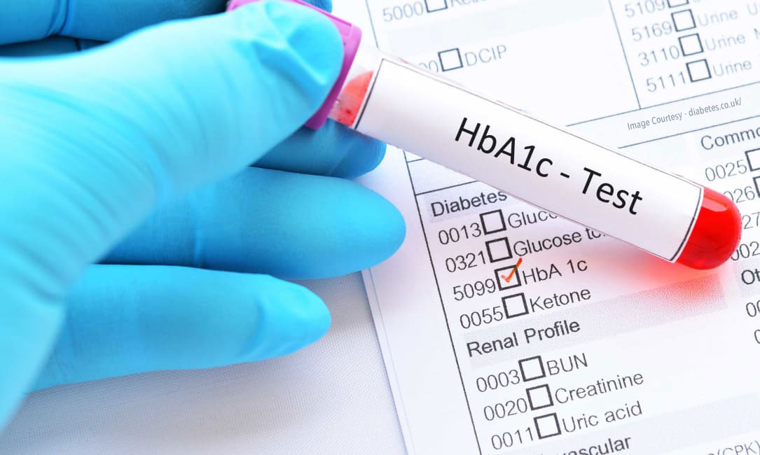 HbA1c Test for different populations